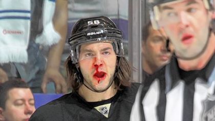 Kris Letang argues a non-call Tuesday that left him bloodied in the Penguins' streak-ending, 1-0 loss in Toronto.
