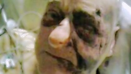 His family provided this photo of Robert C. Ruffing, 76, of Clairton, showing his injuries.