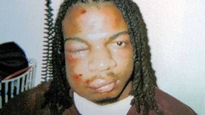 Jordan Miles at a hospital with injuries from an altercation with three Pittsburgh police officers in January 2010.